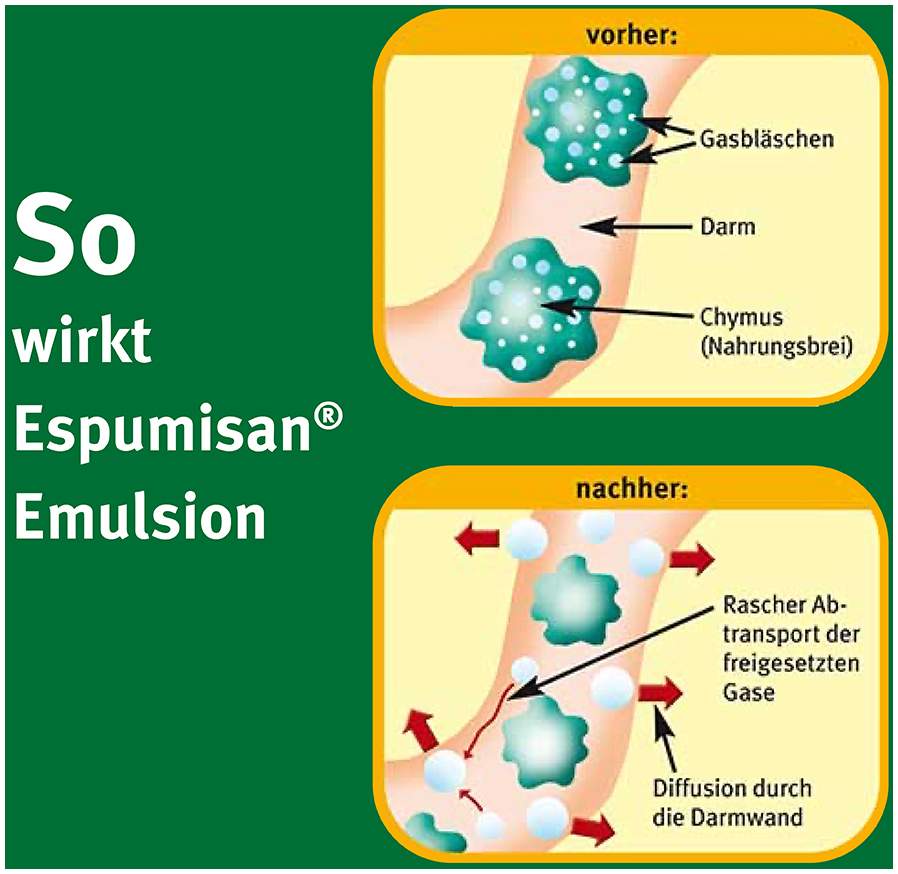 Espumisan Emulsion 30 ml