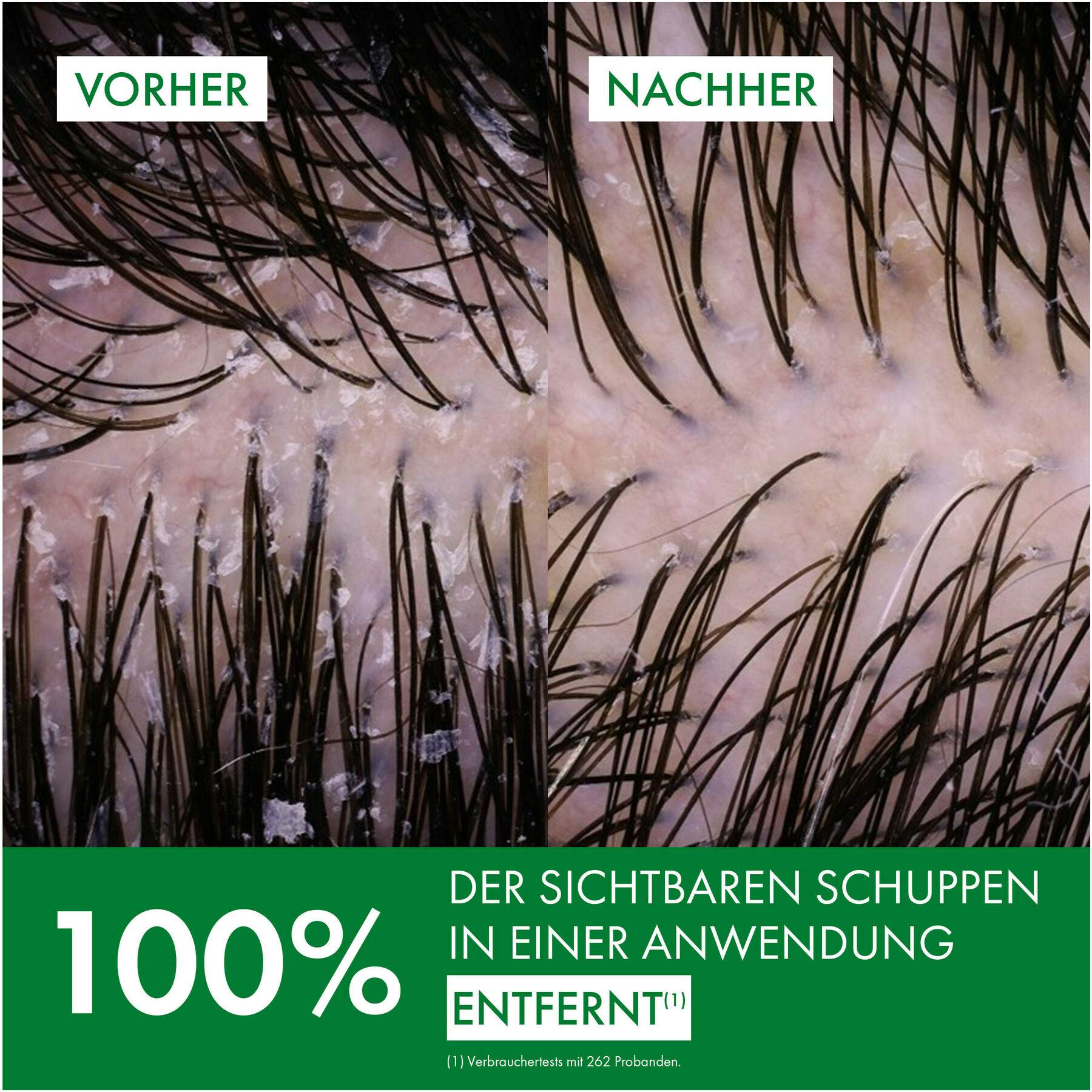 Vichy Dercos Anti-Schuppen Shampoo für fettige Kopfhaut 390 ml