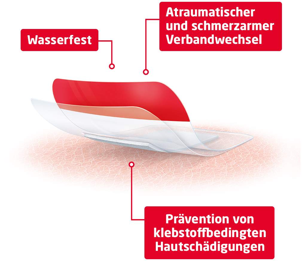 Leukomed T Plus Skin Sensitive Steril 5 X 7,2 cm 5 Stück