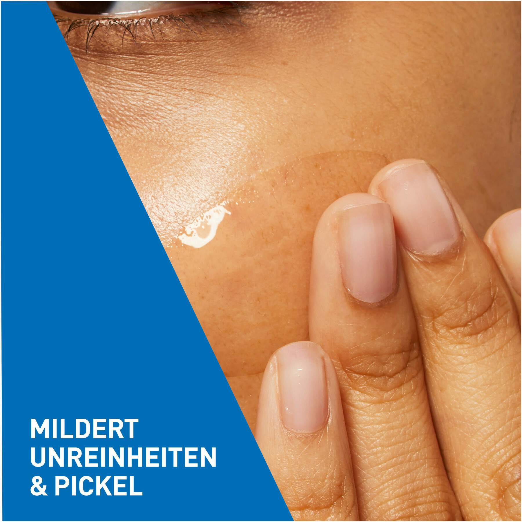 Cerave Anti-Unreinheiten Gel 40 ml