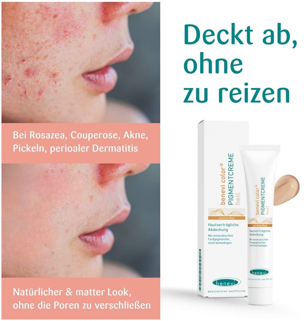 Benevi Color Pigmentcreme Hell 20 ml