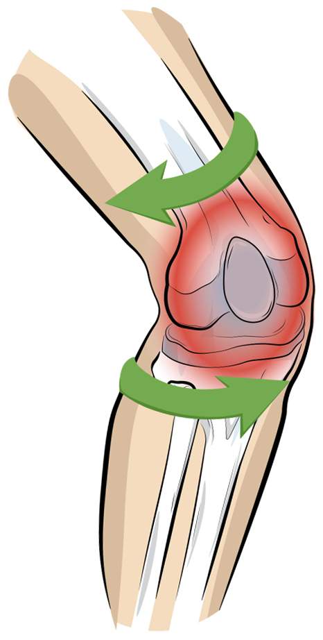 Vital Komfort Kniebandage PatellaTec Gr. L
