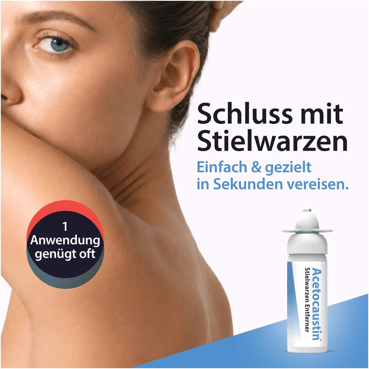 Acetocaustin Stielwarzen Entferner 50 ml Stift