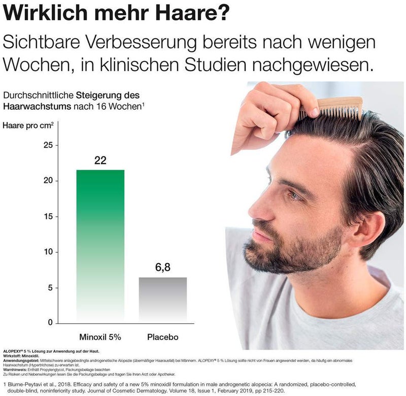 Alopexy 5% Lösung zur Anwendung auf der Haut 3 x 60 ml Lösung