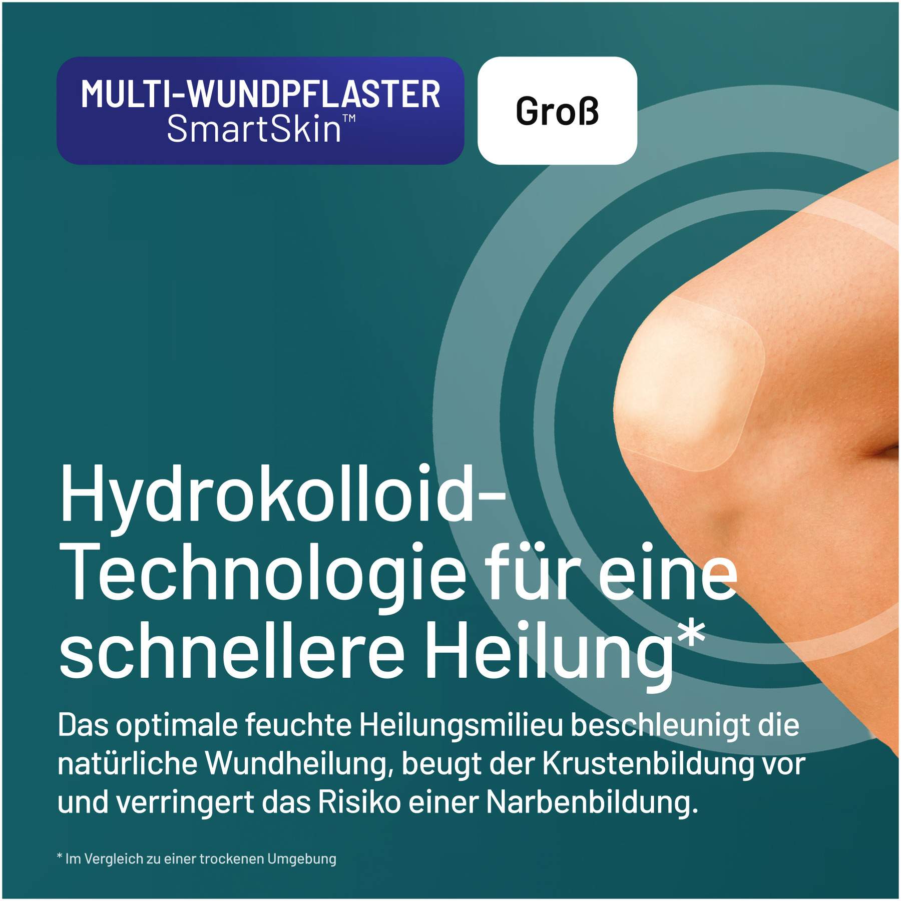 Compeed Multi-Wundpflaster SmartSkin groß 9 Stück