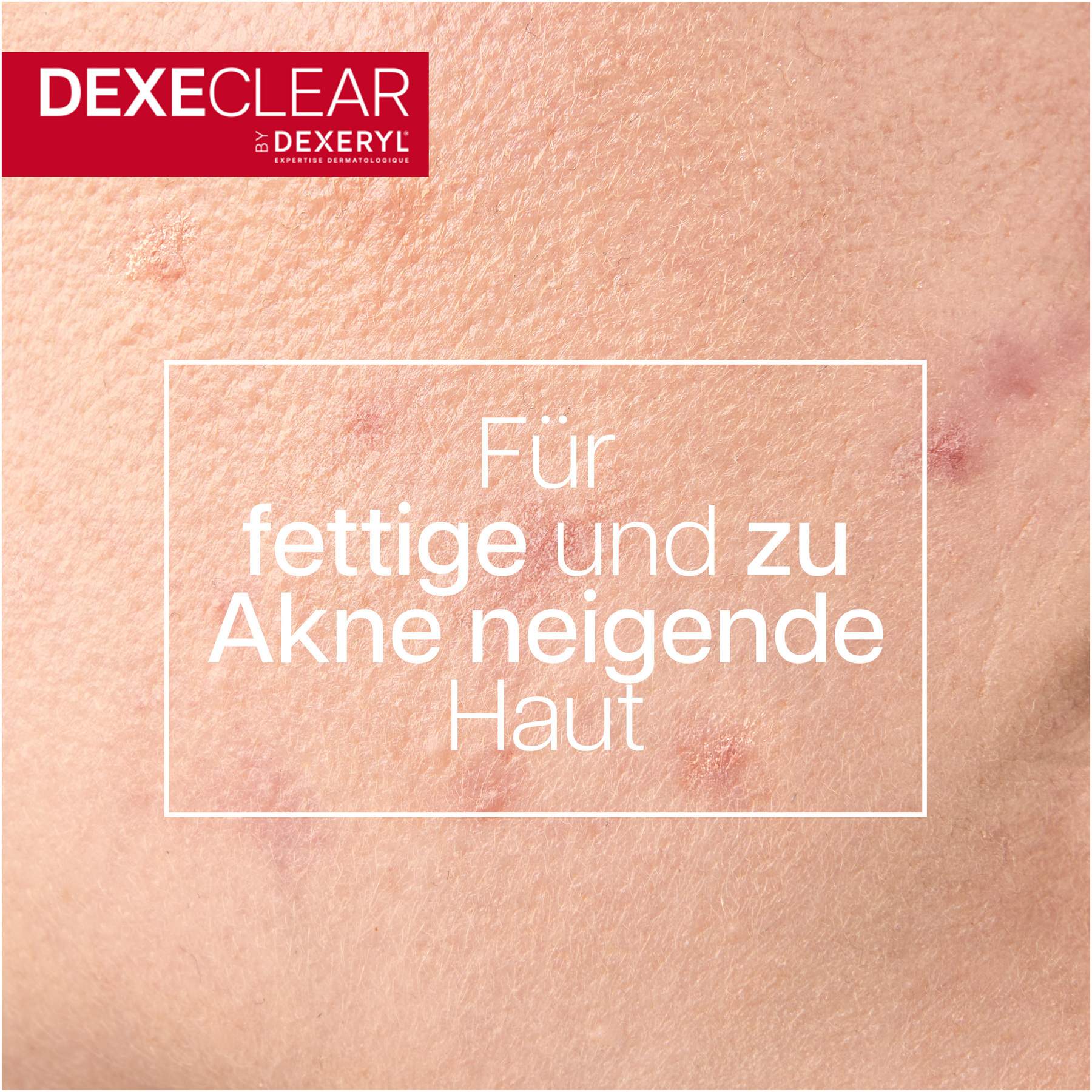 Dexeryl Dexeclear schäumendes Reinigungsgel 200 ml