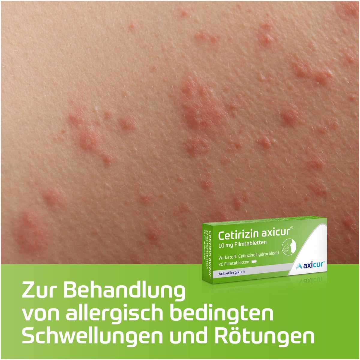 Cetirizin Axicur 10 mg 10 Filmtabletten