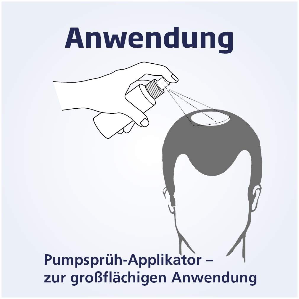 Minoxicutan Männer 50 mg je ml Spray 3 x 60 ml