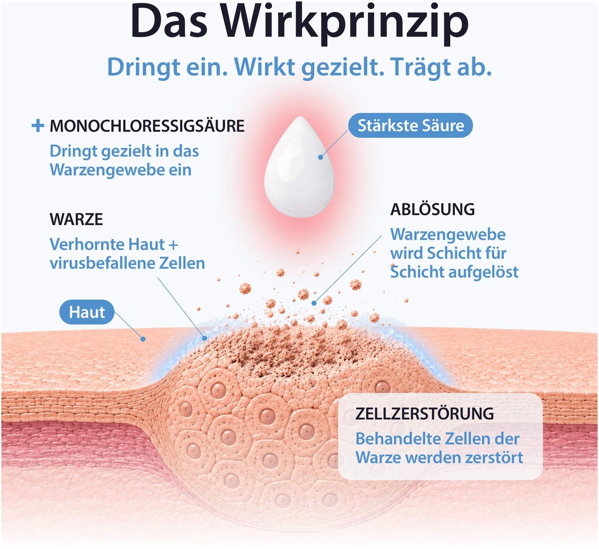 Acetocaustin Lösung Warzenmittel 2 ml