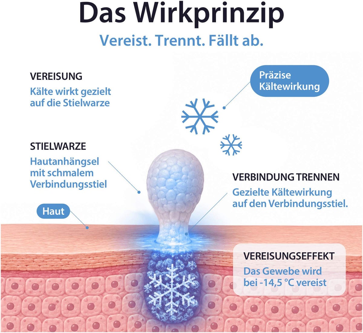 Acetocaustin Stielwarzen Entferner 50 ml Stift