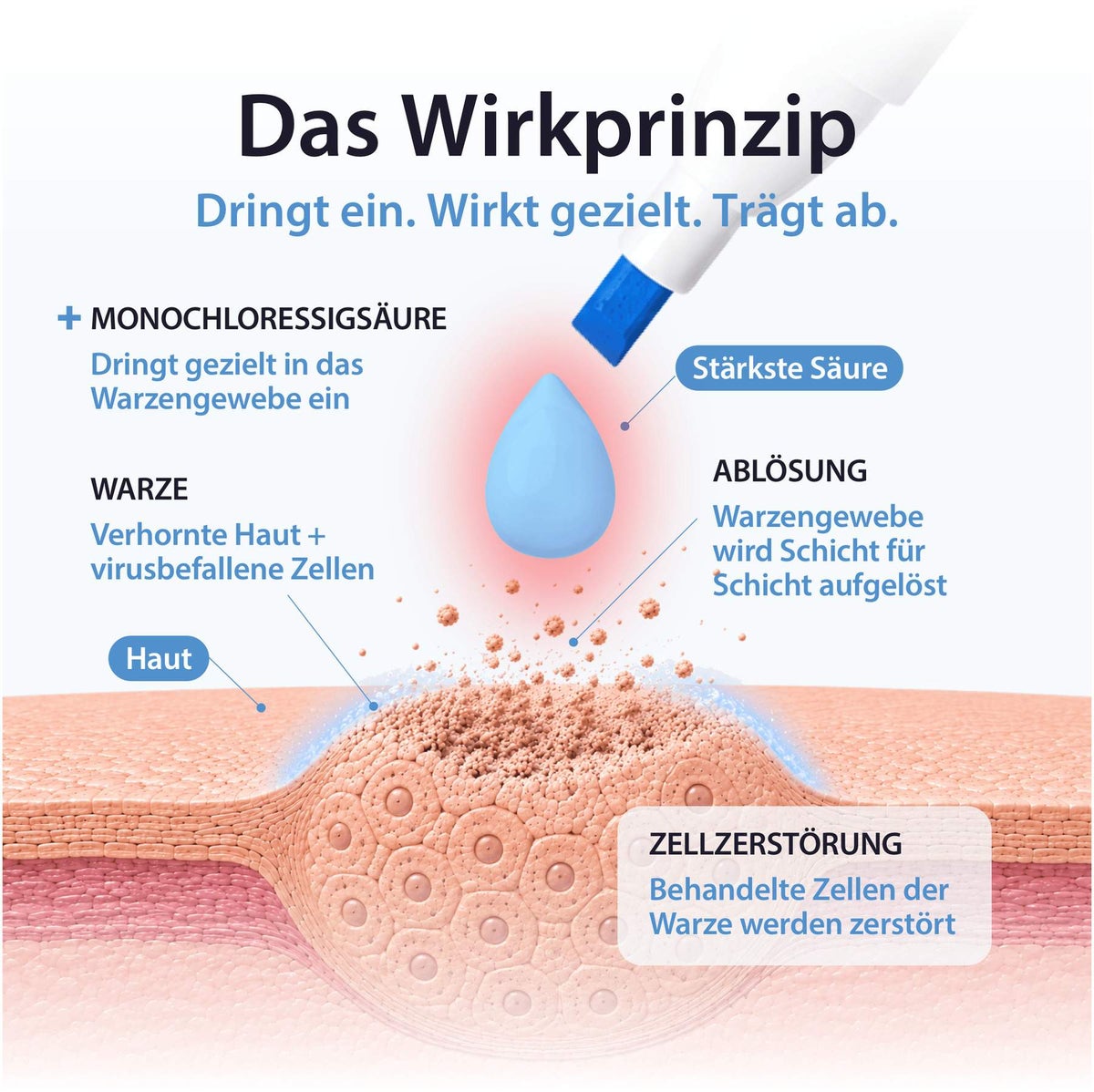 Acetocaustin Stift gegen Warzen 3 ml