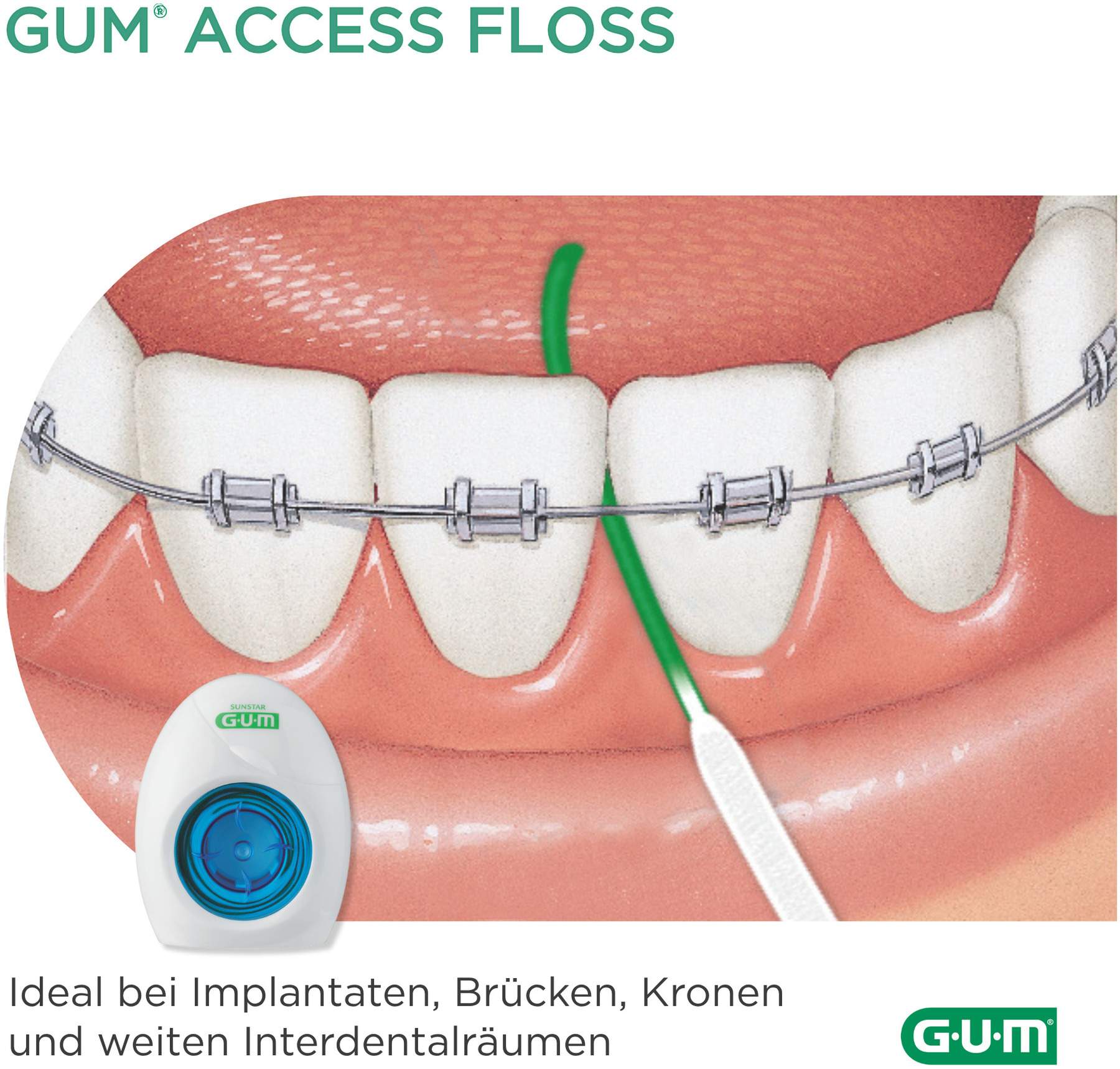 Gum Access Floss 50 Anwendungen