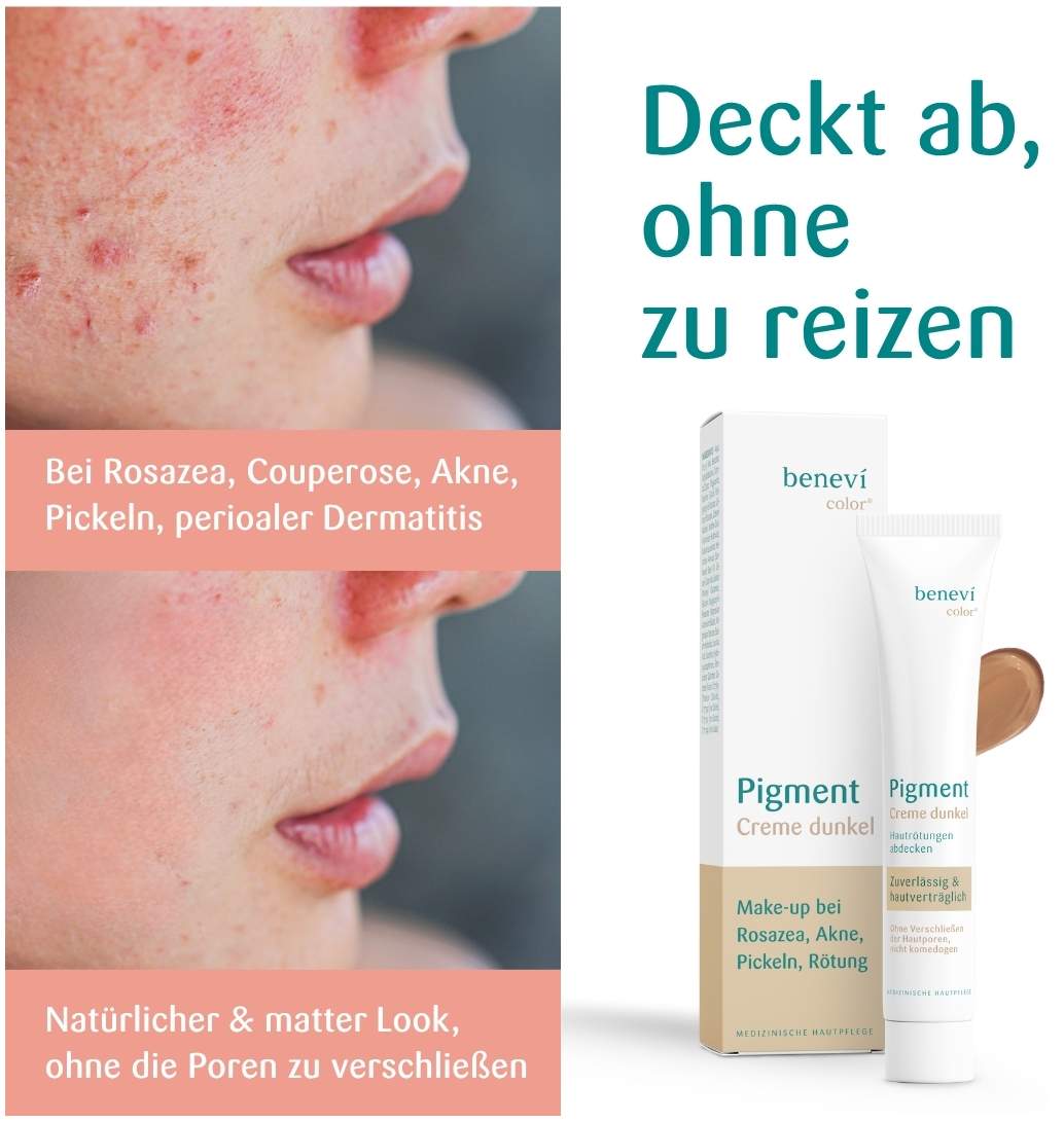 Benevi Color Pigmentcreme Dunkel 20 ml