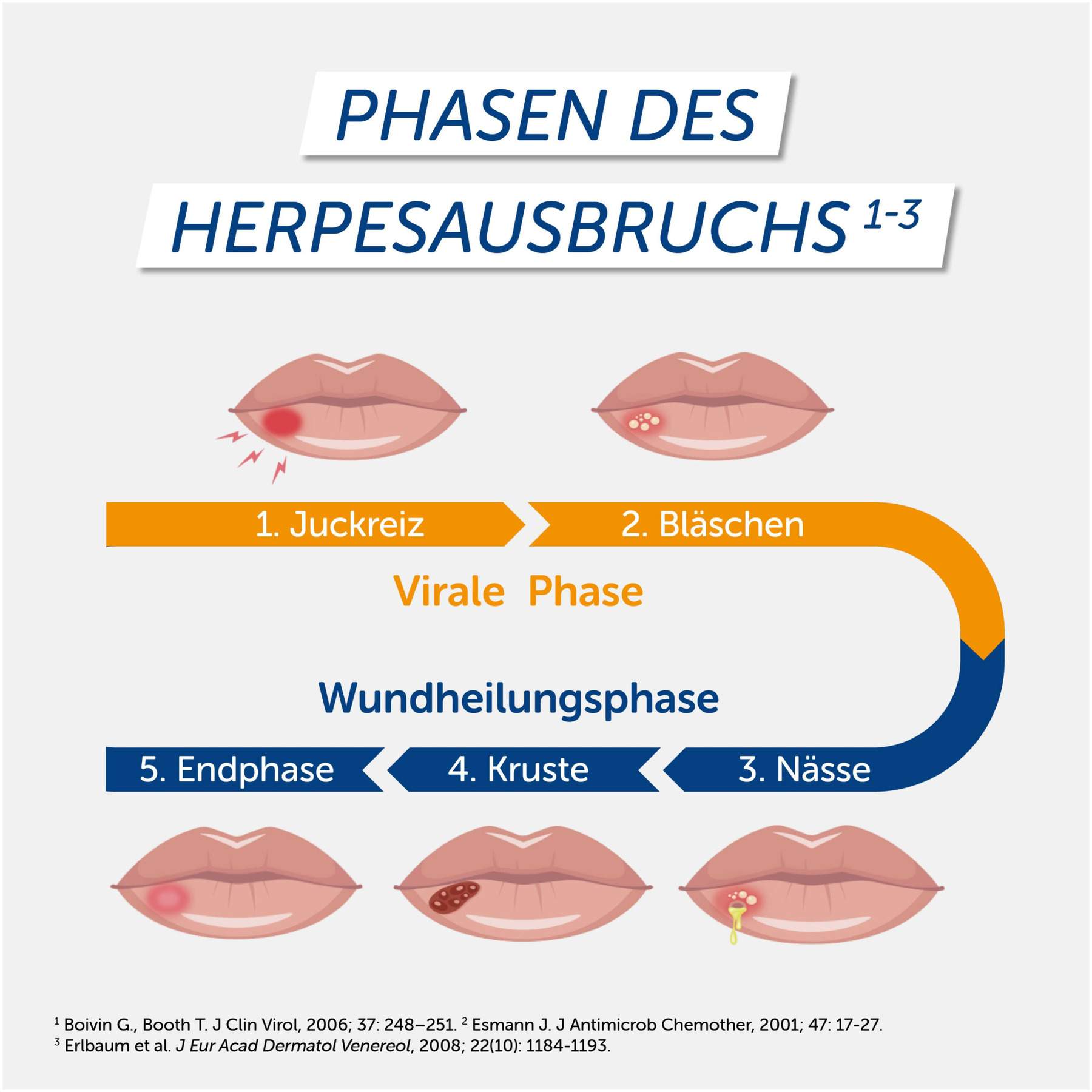 Pencivir bei Lippenherpes 2 g Creme
