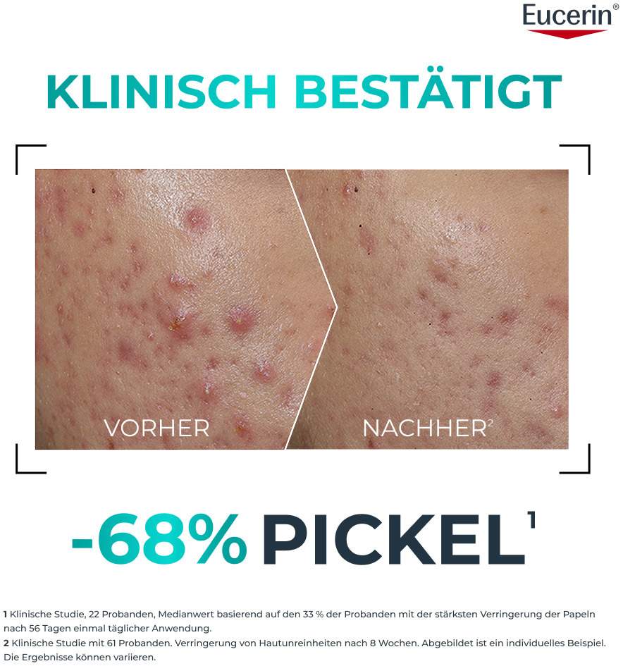 Eucerin DermoPure Clinical Probiom8 Routine-Set 1 Stück