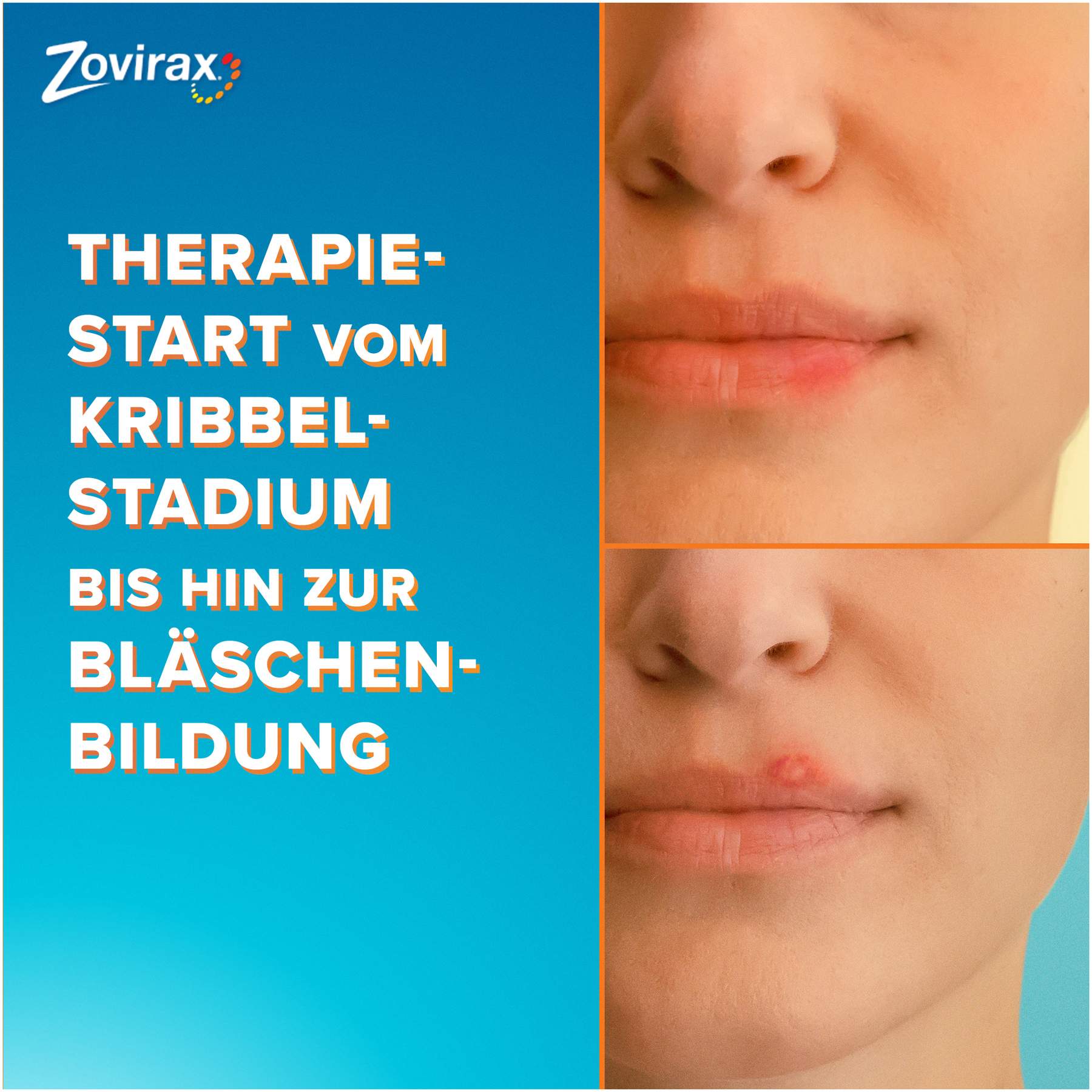 Zovirax Lippenherpescreme 2 g