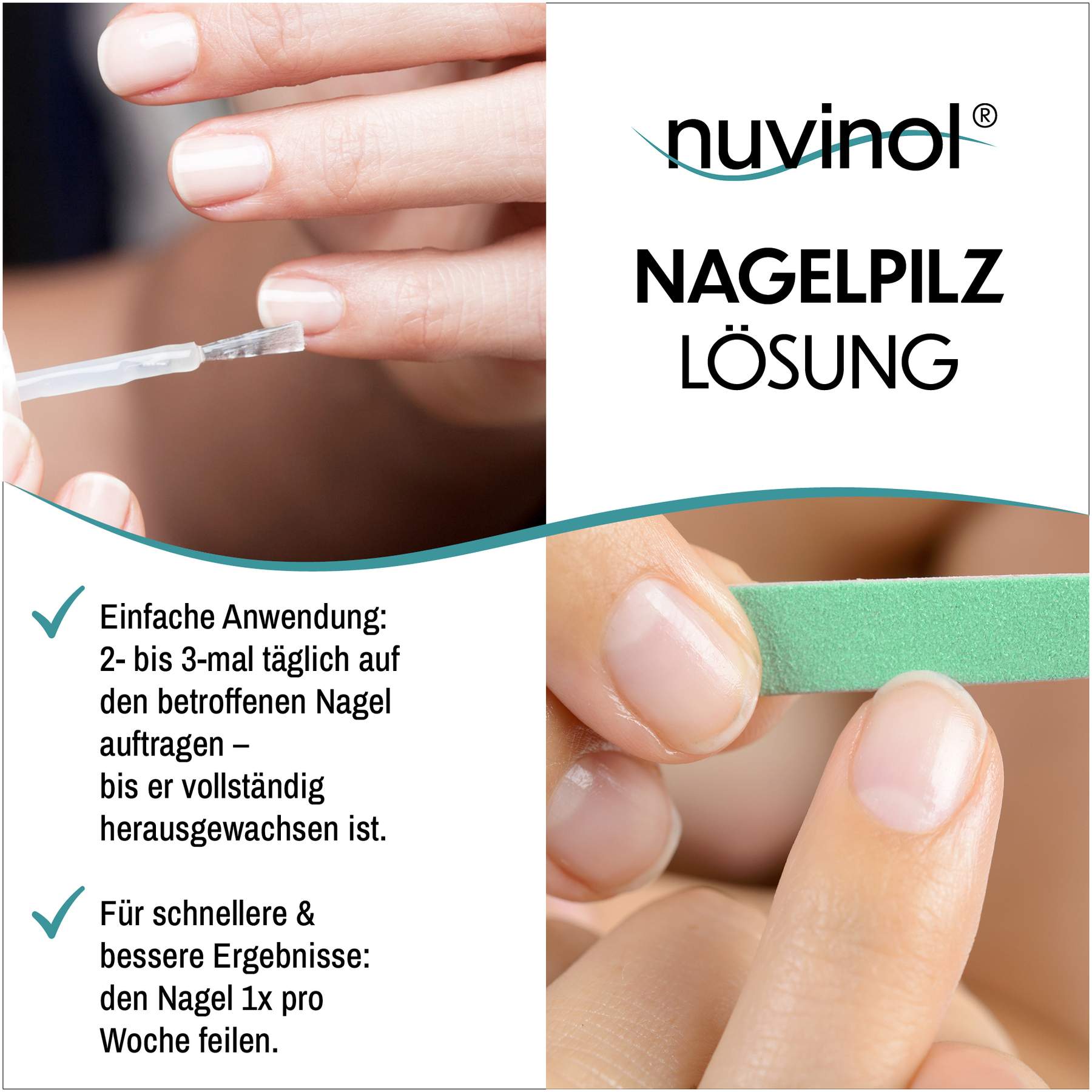 Nuvinol Nagelpilz Lösung 10 ml