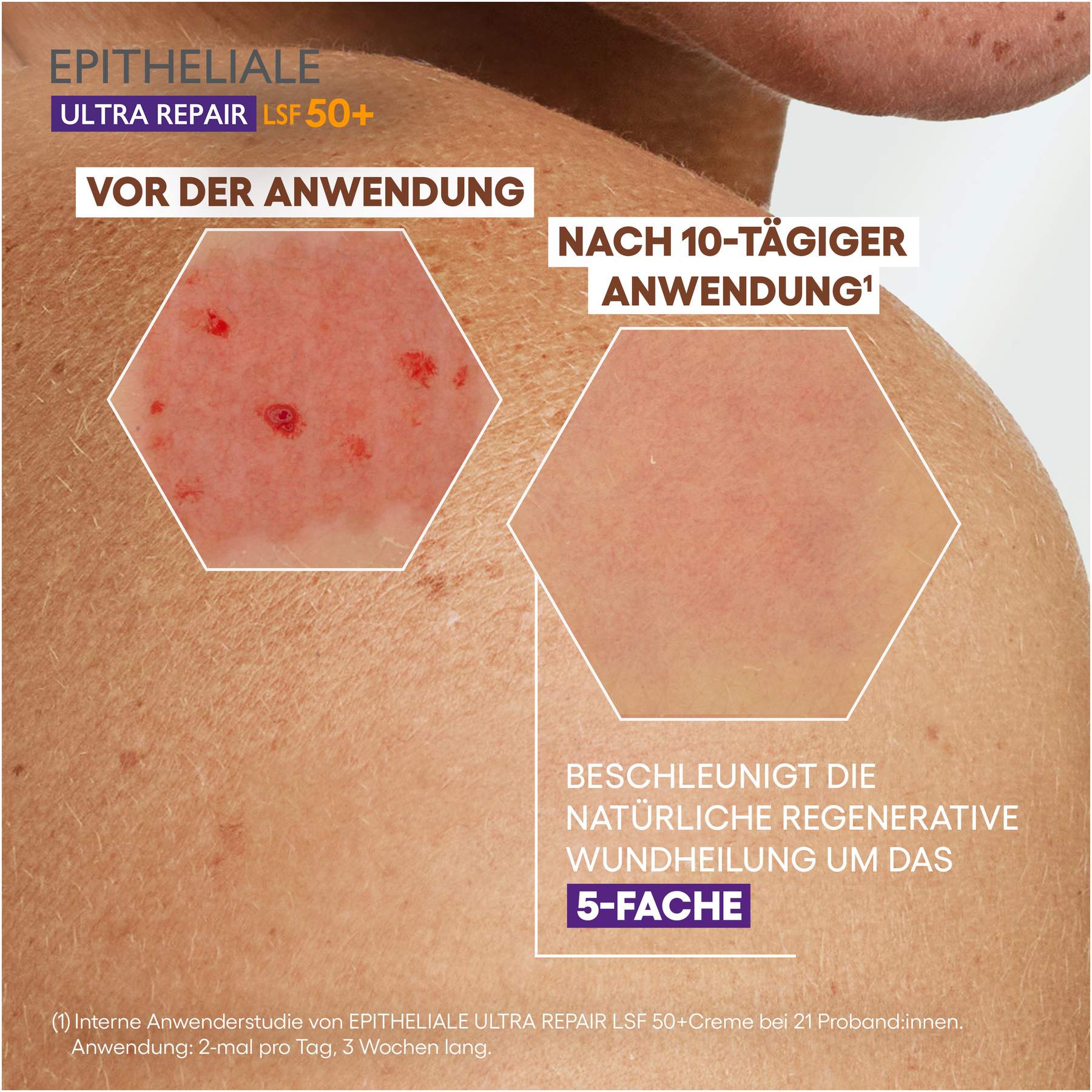 A-Derma Epitheliale Ultra Repair Creme Lsf50+ 40 ml