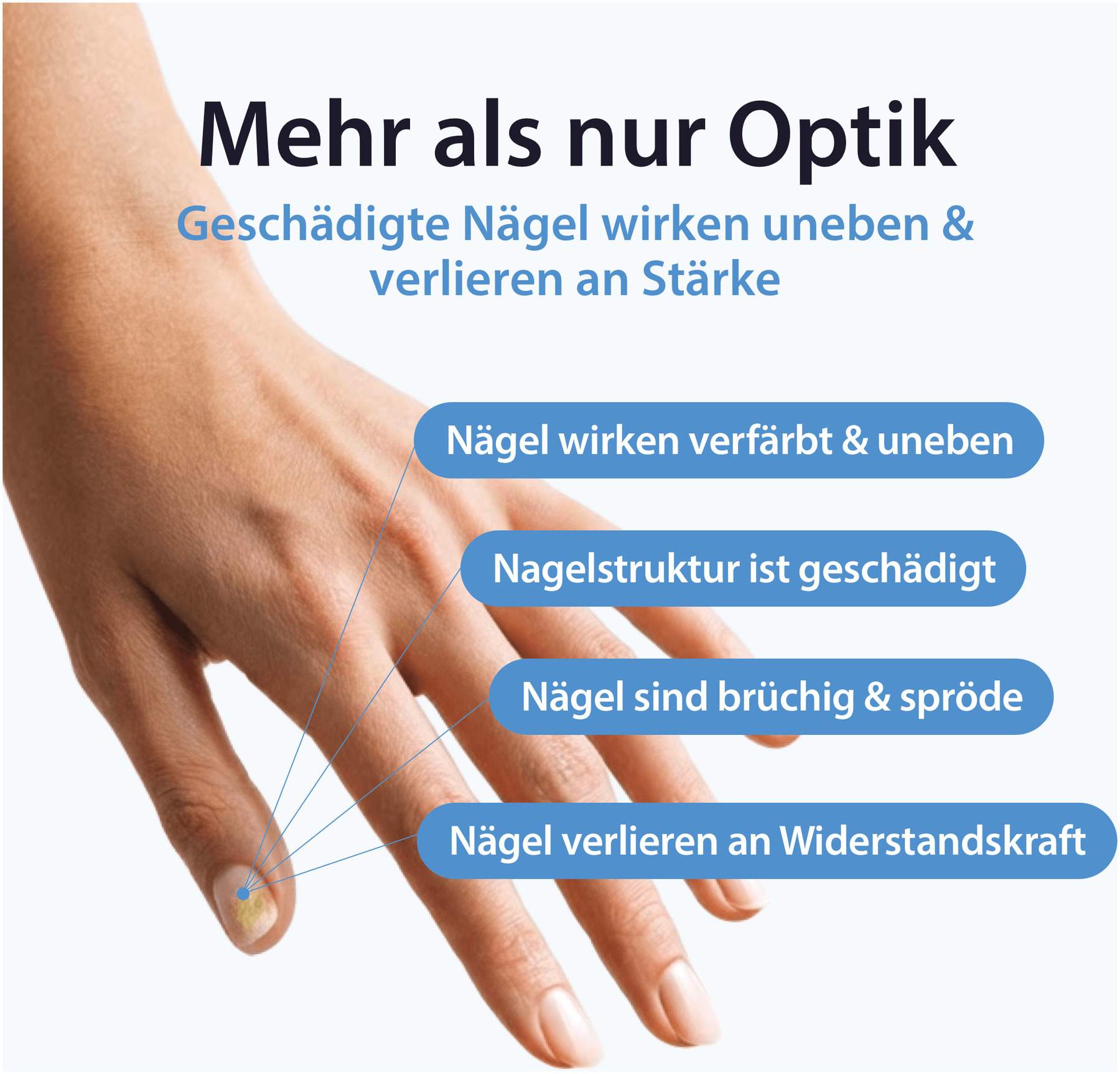 Acetocaustin Nagelpflege & Reparatur Lösung 9 ml