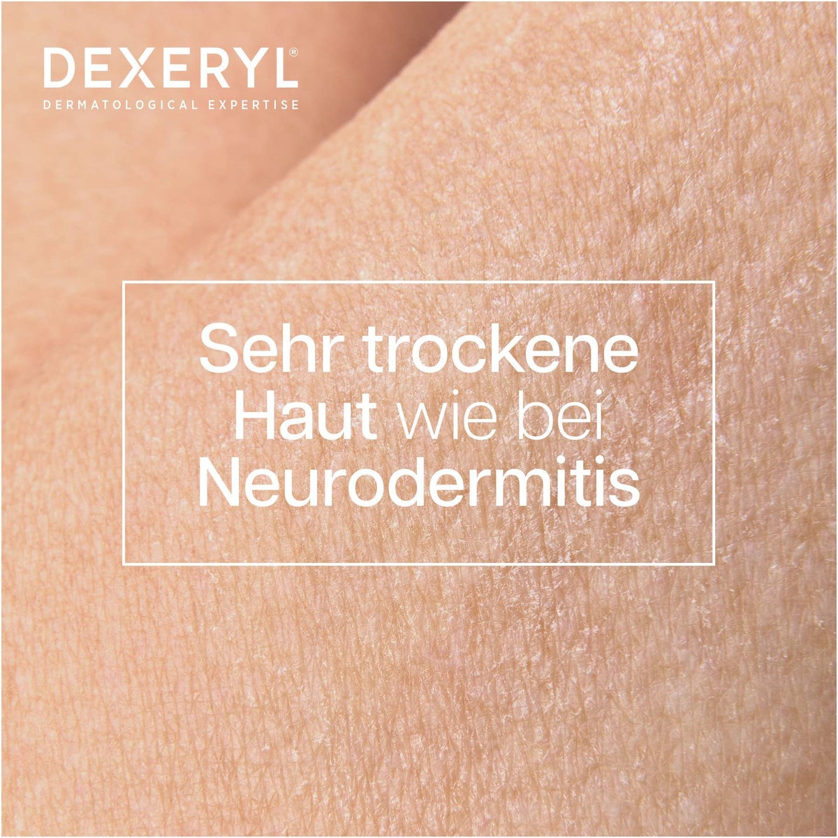 Dexeryl Reinigungsöl 500 ml