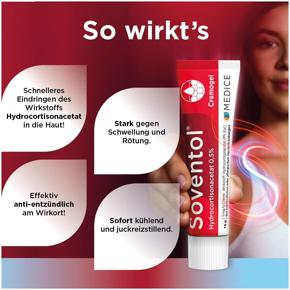 Soventol Hydrocortisonacetat 0,5% 15 g Creme