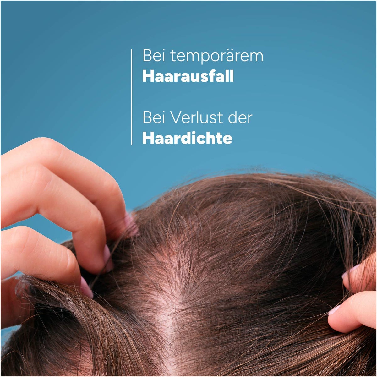 Ducray Anaphase Creastim Lotion bei Temporärem Haarausfall 60 ml