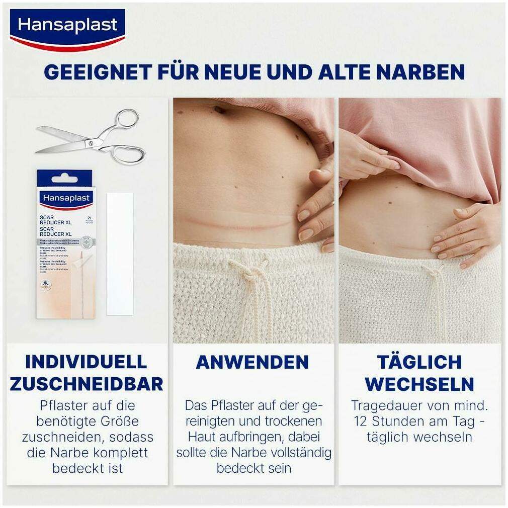 Hansaplast Pflaster Narben Reduktion Xl 3 cm X 14,6 cm 21 Stück