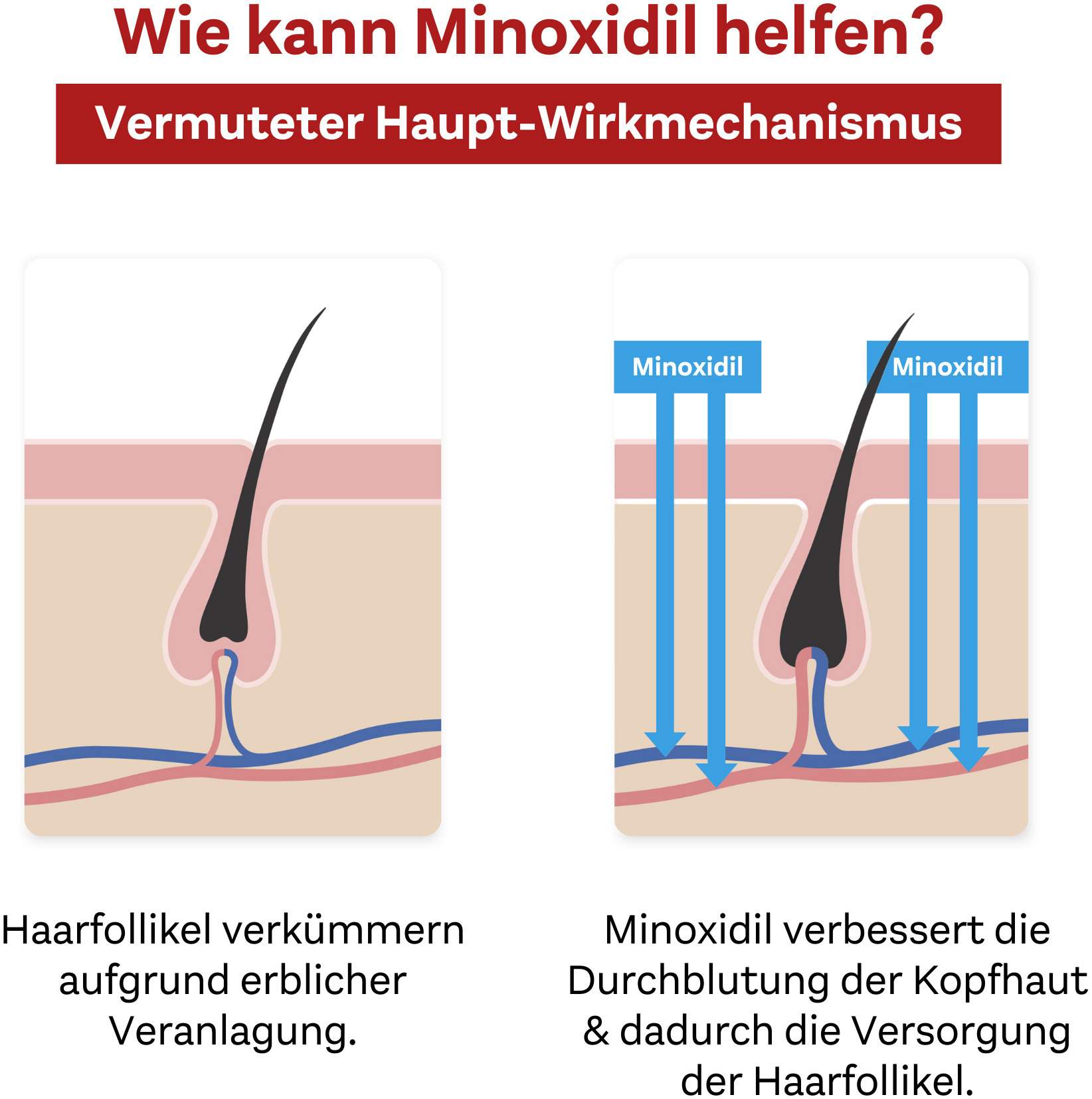 Minoxidil Doppelherz Pharma 50 mg je ml 3 x 60 ml Lösung für Männer