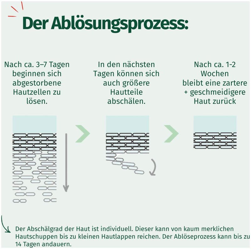 Allgäuer Latschenkiefer Hornhaut Entferner Maske cremig 1 Stück