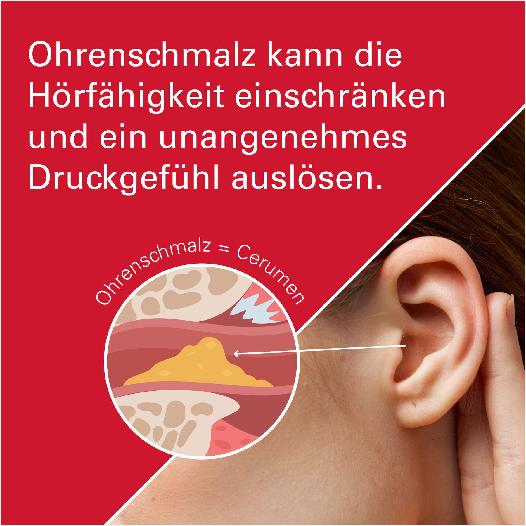 Otitex 10 ml Ohrentropfen