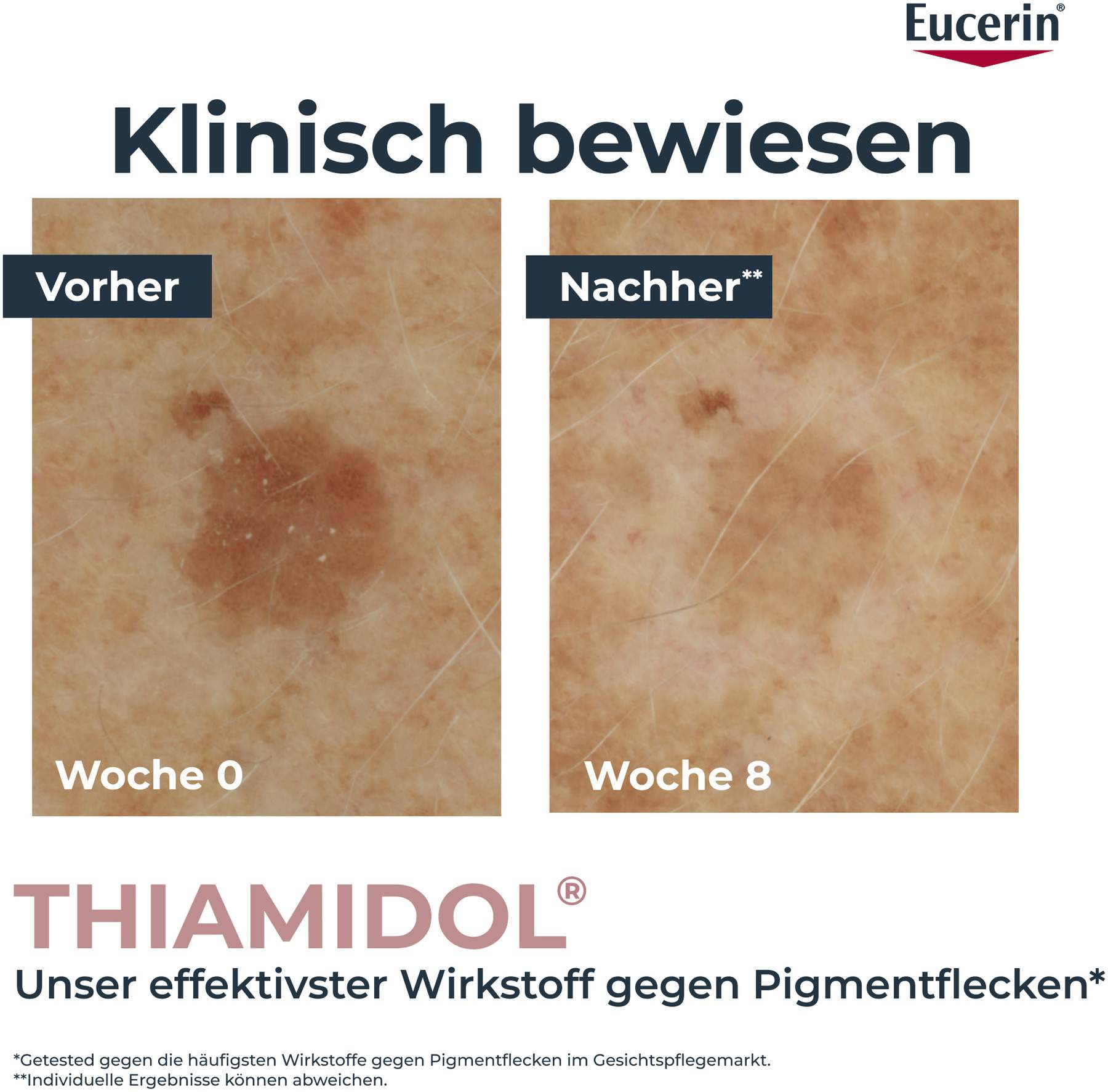 Eucerin Anti-Pigment Korrekturstift 1 Stück