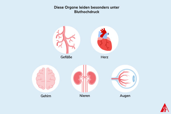 Eine Illustration der Organe, die besonders unter Bluthochdruck leiden. Dazu gehören: Gefäße, Herz, Gehirn, Nieren sowie die Augen.