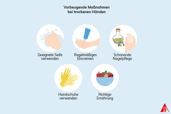 Eine Illustration zu vorbeugenden Maßnahmen bei trockenen Händen. Dazu gehören die Verwendung von geeigneter Seife, Handcreme zu benutzen, schonende Nagelpflegeprodukte zu verwenden, bei sehr sensiblen Händen Handschuhe zu tragen und sowie eine gesunde Ernährung.