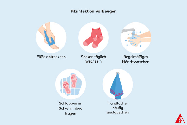 Eine Illustration von Maßnahmen wie man Fußpilz und Nagelpilz vorbeugt. Dazu gehören: Füße abtrocknen, tägliches Sockenwechseln, regelmäßiges Händewaschen, im Schwimmbad Schlappen tragen sowie regelmäßig benutzte Handtücher auzutauschen.